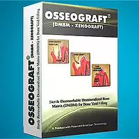 ADVANCE BIOTECH Osseomold